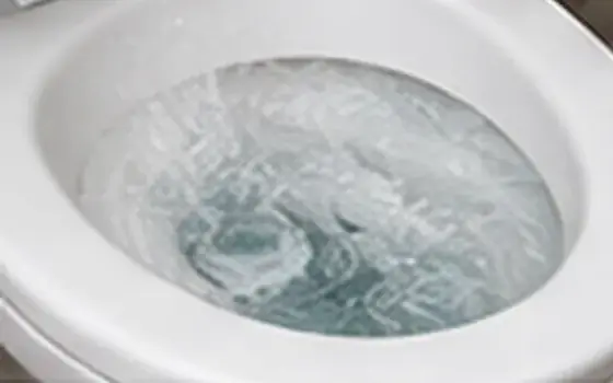 Running toilet โ Toilet Problem Guide โ illustrative photo 2 AI-generated visual example for running toilet โ toilet problem guide
